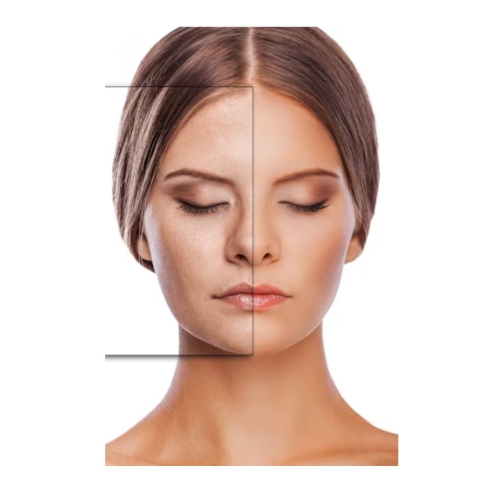 Scars on your face before or after