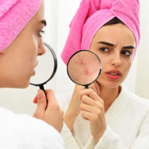 Blackheads with makeup