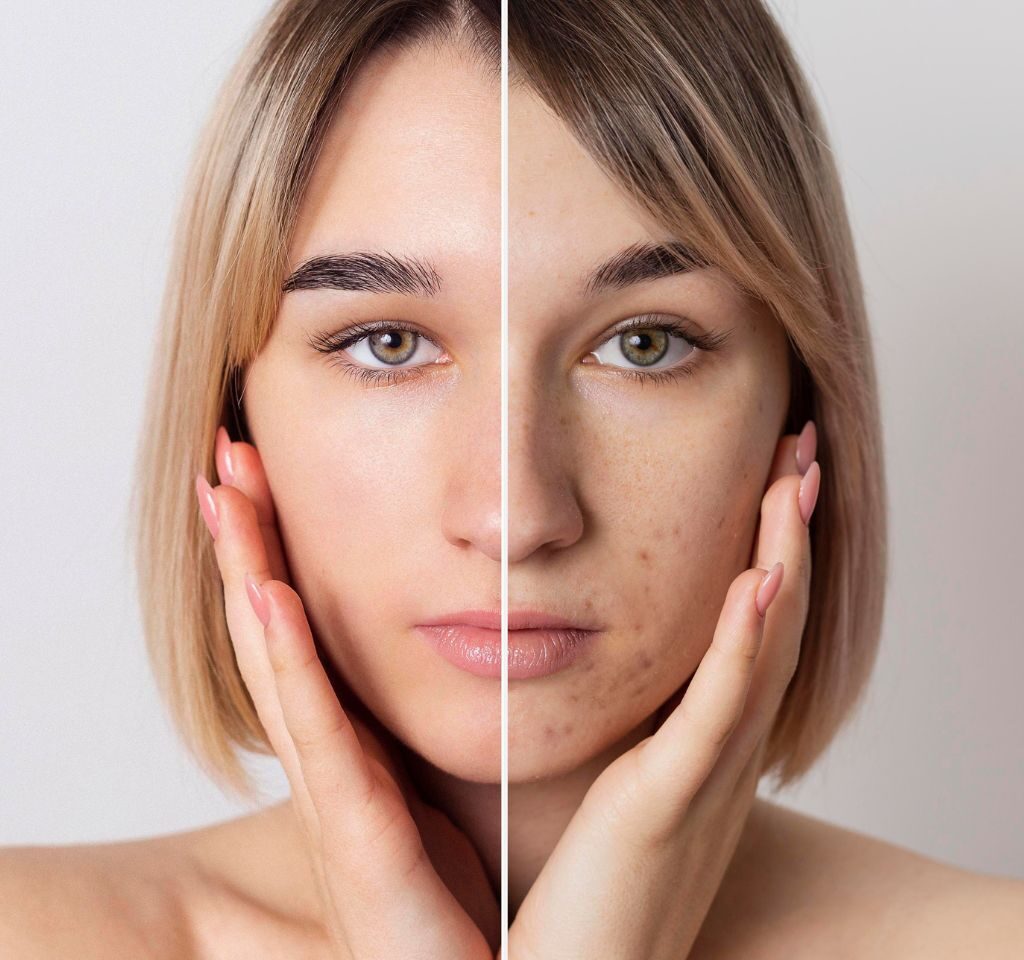 Natural Glow Beauty Cream